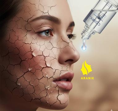 چرا سرم هیالورونیک اسید ۳٪، معجزه پرکننده پوست‌های تشنه است؟